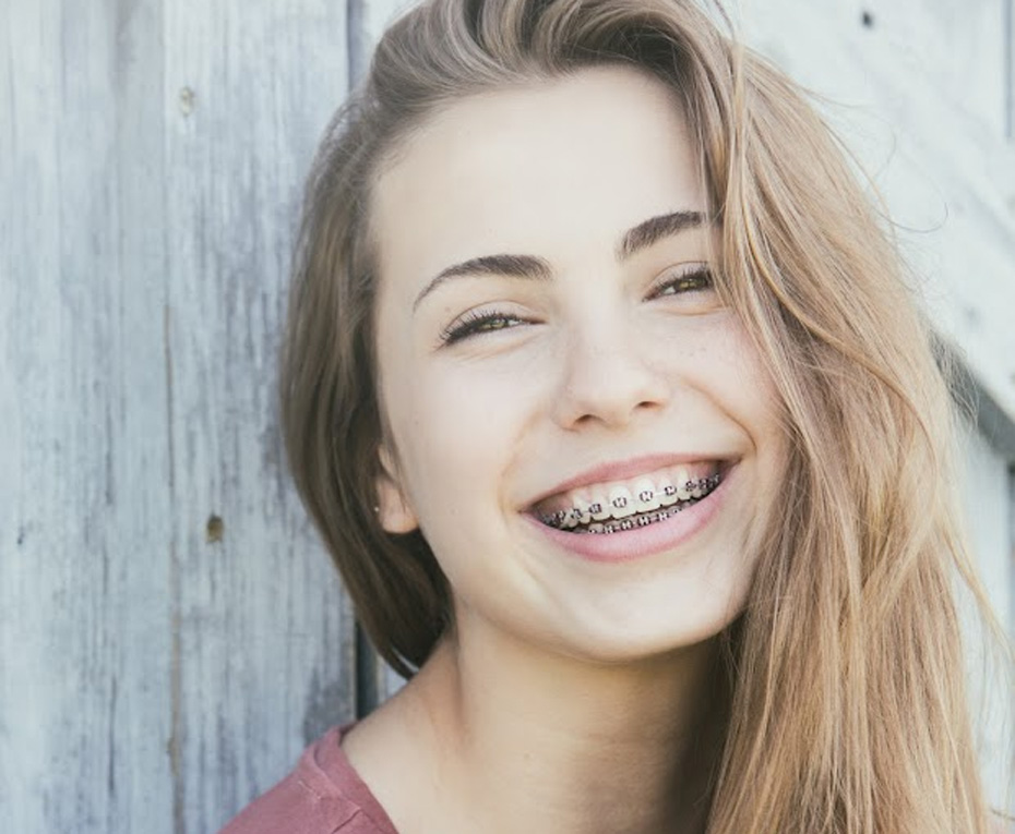Traditional braces for children and teenagers