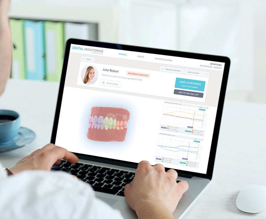 How Dental Monitoring Works In 3 Simple Steps?